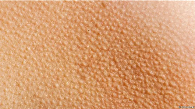 Мурашки по тілу – одна з найрозповсюдженіших реакцій "шкірного оргазму", але існує й багато інших