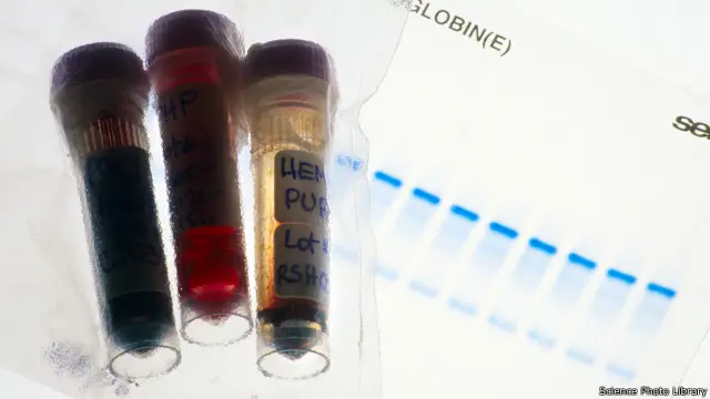 血液檢驗樣本(資料圖片)