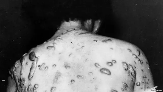 घायल आदमी