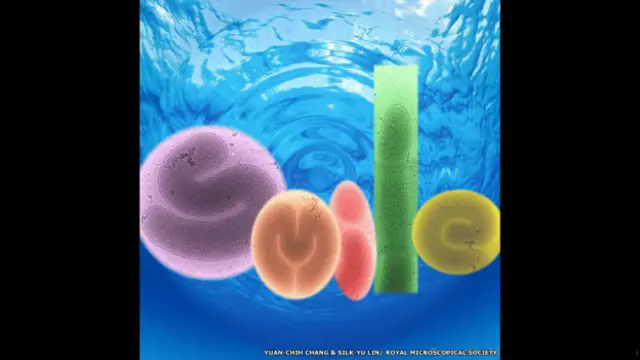 La bacteria marina "Simiduia agarivorans"