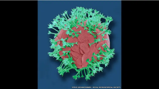 "Perfección Planctónica" de Steve Gschmeissner