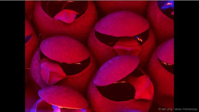 'Angry Birds' - Gambar SEM dengan rekayasa warna menunjukkan sejumlah telur serangga yang tengah menetas, bentuknya mirip seperti karakter game terkenal bukan? 