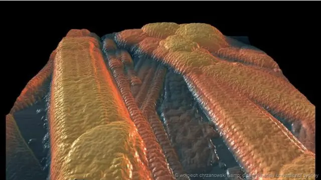 'Kolagen' - Fibril kolagen diekstrak dari kulit manusia dan dicitrakan menggunakan roket pemindai mikroskopis. 
