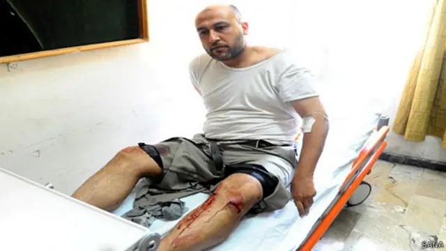 خبرگزاری سوریه تصاویری از قربانیان حملات روز چهارشنبه منتشر کرده است