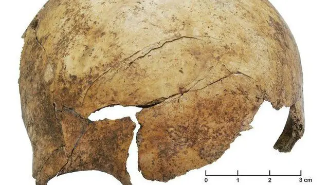 قبر سے ملنے والی ایک بچے کی کھوپڑی