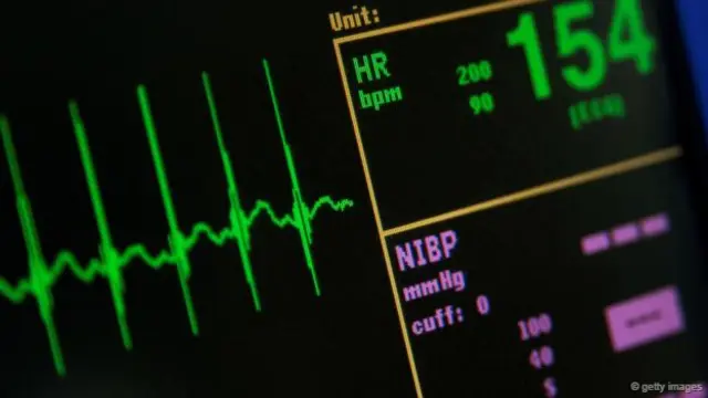 错误的药物剂量也可能是导致死亡率上升的幕后真凶。（图片来源：Getty Images）