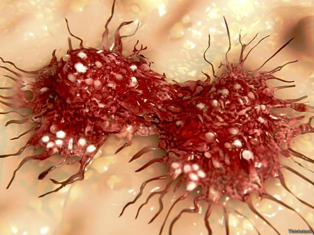 Células cancerosas podem ser transformadas em tecido saudável, dizem cientistas