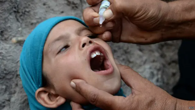 Поліомієліт