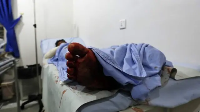 یمن میں جاری لڑائی میں چھ ہزار سے زیادہ افراد ہلاک ہو چکے ہیں