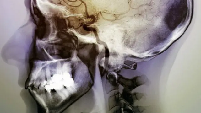 ماہرین کا کہنا ہے کہ دماغ میں انسولر کورٹیکس کے رول کو سمجھنے کے لیے ابھی مزید تحقیقات کی ضرورت ہے