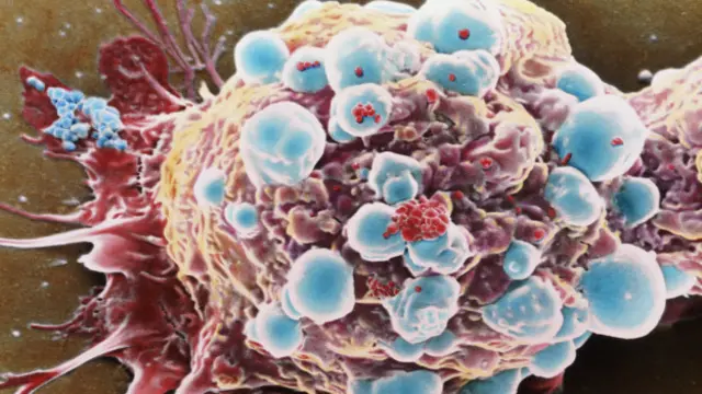 Раковая клетка