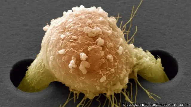 الجهاز الجديد نجح في التقاط الخلايا السرطانية في المكان المزروع فيه وكذلك قلل من عدد الخلايا الخبيثة في مناطق أخرى عند تجربته على فئران مصابة بسرطان الثدي