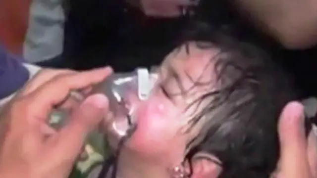 Seorang anak menderita setelah pasukan pemerintah Suriah menembakkan gas klorin. 