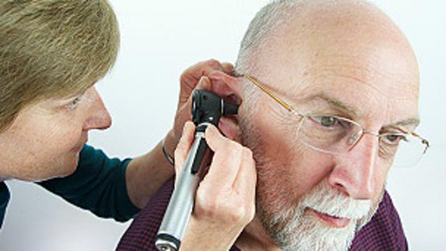 3 medidas para eliminar la cera en el oído durante la cuarentena 