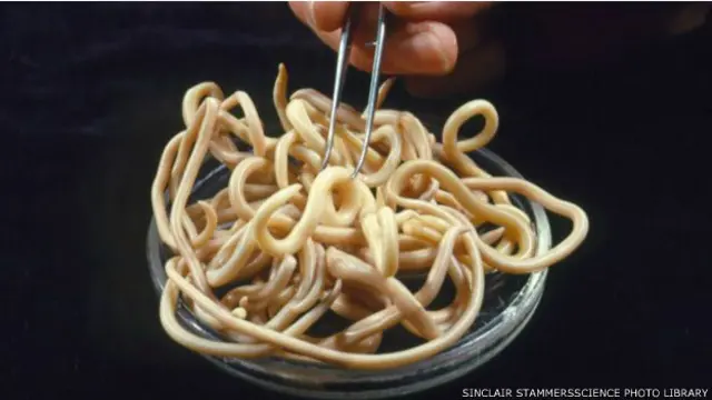 دودة الاسكارس التي تعيش في الامعاء الدقيقة وتعتبر واحدة من أكثر الديدان الطفيلية شيوعا على نطاق العالم