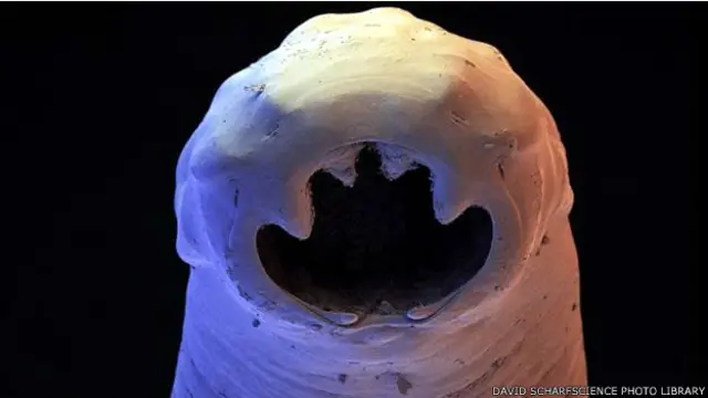 دودة الانكلستوما التي تصيب الأمعاء الدقيقة والاثني عشري تستخدم اسنانها لتعلق بجدار الامعاء