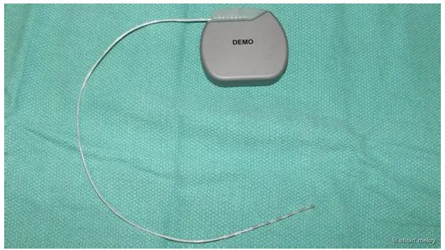 Thiết bị Orgasmtron