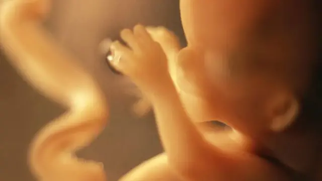 Los guevedoces son deficientes en una enzima conocida como 5-alfa reductasa.