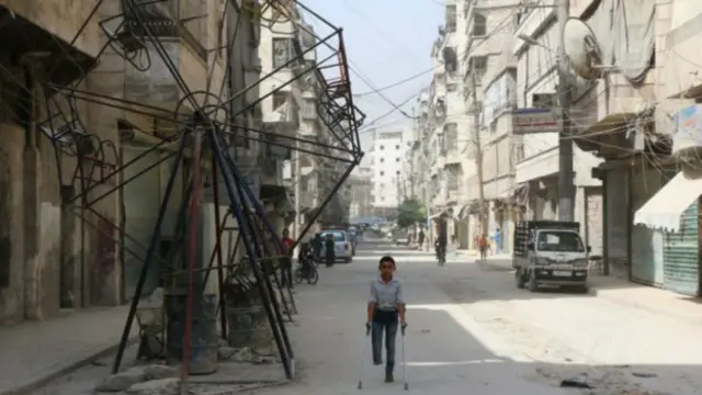 Niño lisiado por la guerra en Siria