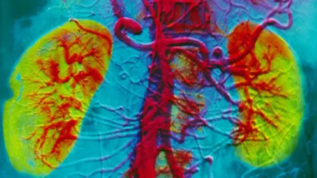 වකුගඩු රෝගයෙන් ජනතාව බේරා ගැනීම පිණිස රජරට ගොවි ජනතාවට පිරිසිදු පානීය ජලය ලබාදිය යුතු බවයි ආචාර්ය ජයසුමන පවසන්නේ 