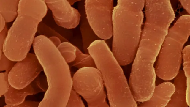 குறிப்பிட்ட நான்குவகை பாக்டீரியாக்கள் உடலில் இல்லாத குழந்தைகளுக்கு ஆஸ்த்மா வரும் ஆபத்து அதிகம்