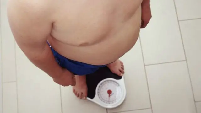 ڈبلیو ایچ او کی رپورٹ کے مطابق آبادی کے 59 فیصد لوگوں کا یا تو وزن زیاہ ہے یا پھر وہ موٹے ہیں