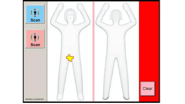 Di Twitternya, Petosky memajang ilustrasi yang dibuat temannay terkait kejadian yang menimpanya