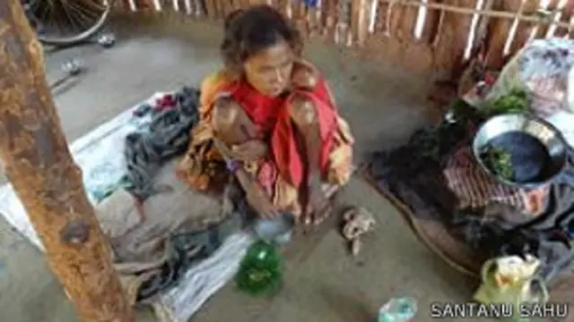 टीबी की बीमारी से ग्रस्त सबर महिला.