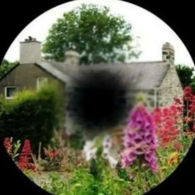 فقدان الرؤية بمرض التنكس البقعي.