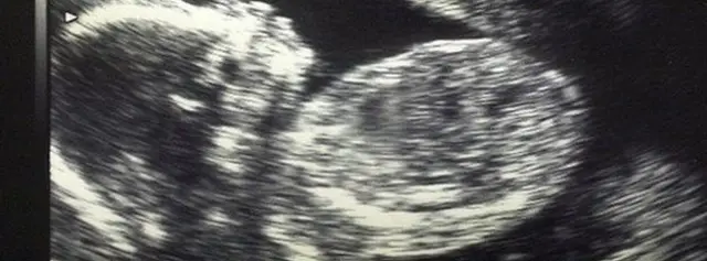 Плод в утробе матери
