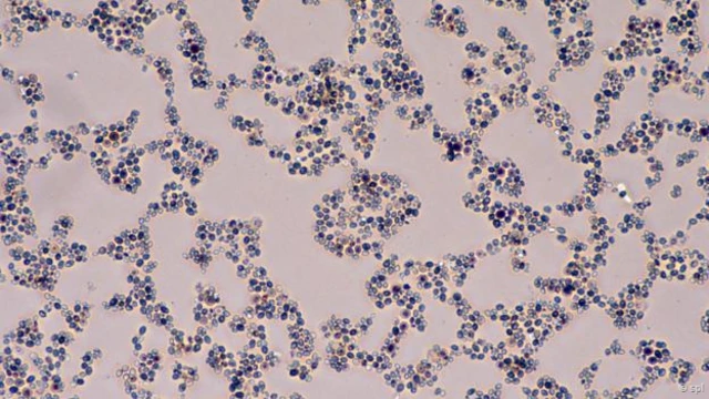 如果你肚子裏的酵母菌過多,就會發生奇怪的事情(圖片來源:SPL)