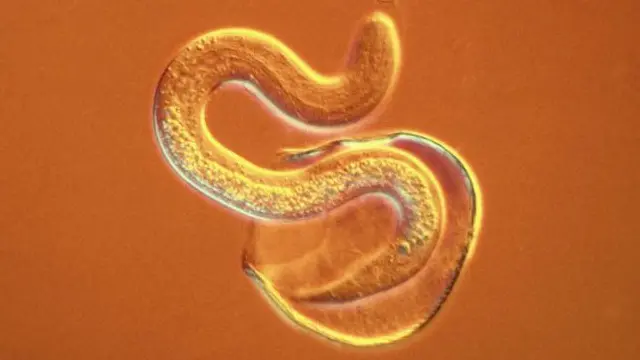 الطفيليات الدودية تؤثر على ثلث سكان العالم وتسبب عددا من الأمراض من بينها عمى النهر وداء الخيطيات اللمفاوية