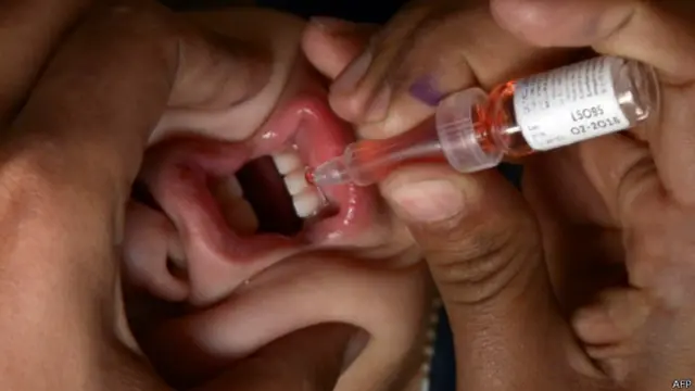 کراچی میں رواں سال سامنے آنے ولا پولیو کا کیس محسود خاندان کی ایک بچی میں پایا گیا ہے