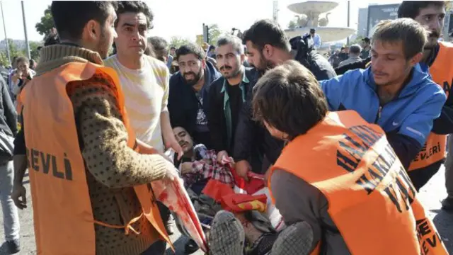 Ankara: las impactantes imágenes del mayor atentado en la historia de  Turquía - BBC News Mundo