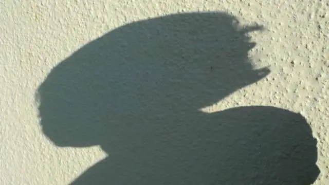 بچوں کی ایک فلاحی تنظیم کے مطابق یہ سمجھنا غلط ہوگا کہ صرف افریقی باشندے ہی اس مسئلے کا شکار ہیں