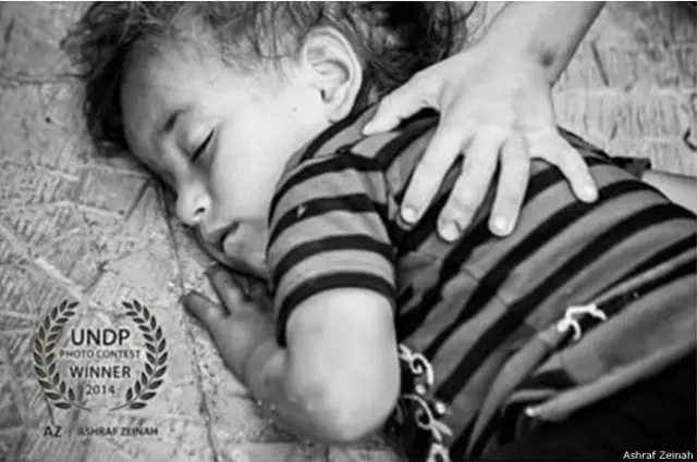 Meskipun dia bisa menangkap momen-momen bahagia, perang tidaklah jauh dari Latakia, Zeinah mengatakan dia sering berkunjung ke kamp-kamp untuk memotret orang yang melarikan diri dari konflik, termasuk anak ini. "Latakia tidak terpengaruh secara langsung, tapi kami menderita dalam masalah yang berbeda," katanya, termasuk pemadaman listrik dan pelayanan publik yang minim. Meskipun dilanda perang, Zeinah mengatakan ia ingin tetap berada di Suriah dan memotret.