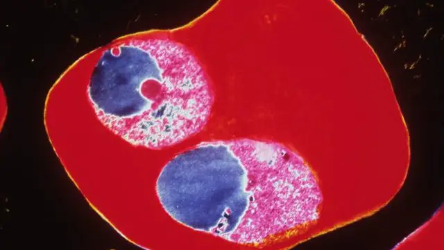 يقاوم الطفيل عقار أرتيميسينين الرئيسي المستخدم في مكافحة الملاريا