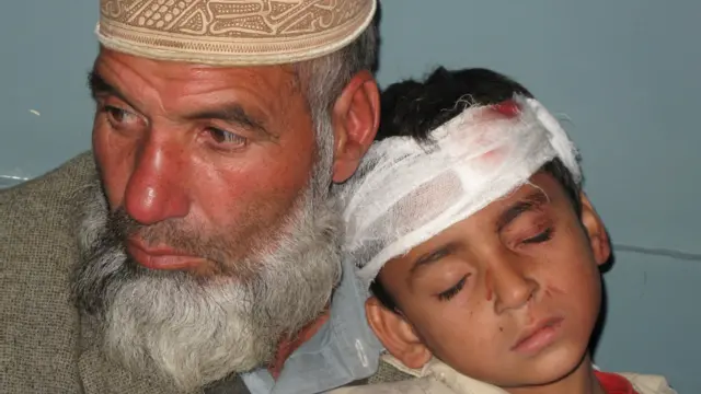 طفل مصاب، سوات، باكستان.