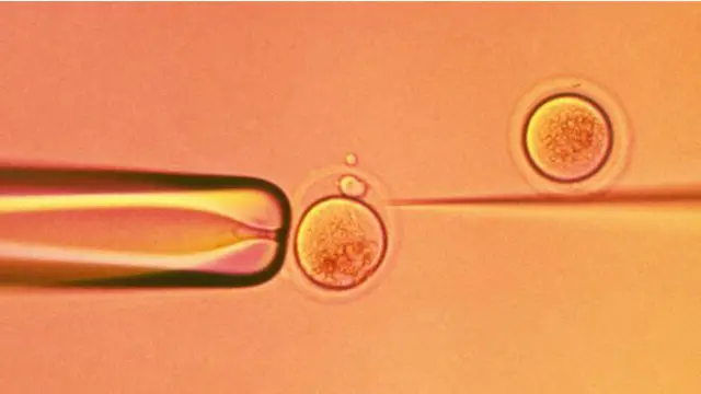 Fertilización artificial de un óvulo