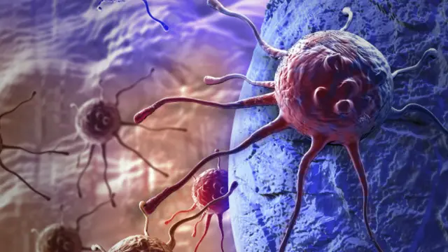 कैंसर कोशिकाएं