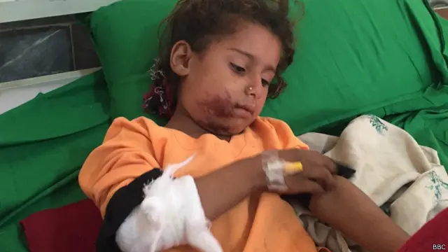 باجوڑ ایجنسی کے واحد ہیڈکوارٹر ہسپتال میں بدستور دور دراز علاقوں سے زخمیوں کو لایا جارہا ہے