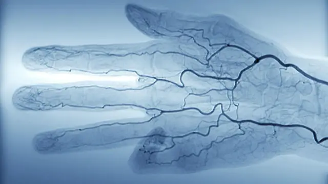 這台手術需要用生理鹽水替換人體的所有血液。（圖片來源：SPL）