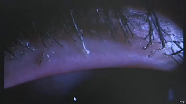 Extension de pestañas