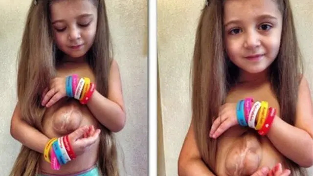 A Pentalogíafreebet kebaya4dCantrellfreebet kebaya4dque padece Virsaviya afeta a localização e desenvolvimentofreebet kebaya4dalguns órgãos vitais.