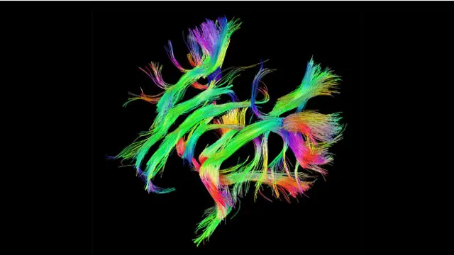 Проект "Коннектом человека" Human Connectome Project, представляющий сети белого вещества мозга, называют последним рубежом картографии