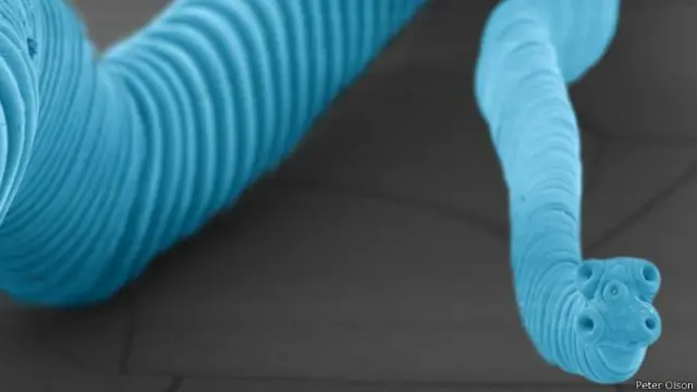 Parásito que causó el cancer