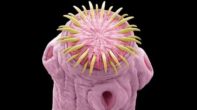 دودة شريطية