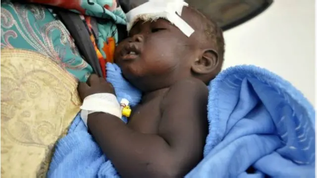 Uyu mwana w'amezi 14 ariko aravurigwa mw'ishure ry'ubuvuzi ry'i Juba