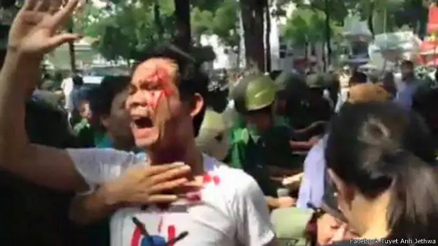 Hình ảnh một người Việt Nam biểu tình phản đối chuyến thăm bị đổ máu đã được lan truyền khá nhanh trên mạng xã hội.