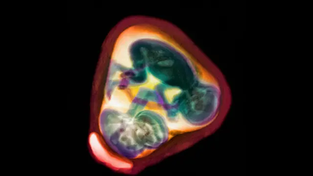 Рождение многочисленных близнецов или тройняшек теоретически может привести к появлению в семье большого количества детей, но риск для здоровья велик